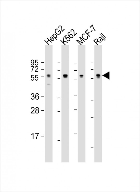 All lanes : Anti-MPIP3 Antibody at 1:1000-1:2000 dilutionLane 1: HepG2 whole cell lysateLane 2: K562 whole cell lysateLane 3: MCF-7 whole cell lysateLane 4: Raji whole cell lysateLysates/proteins at 20 μg per lane