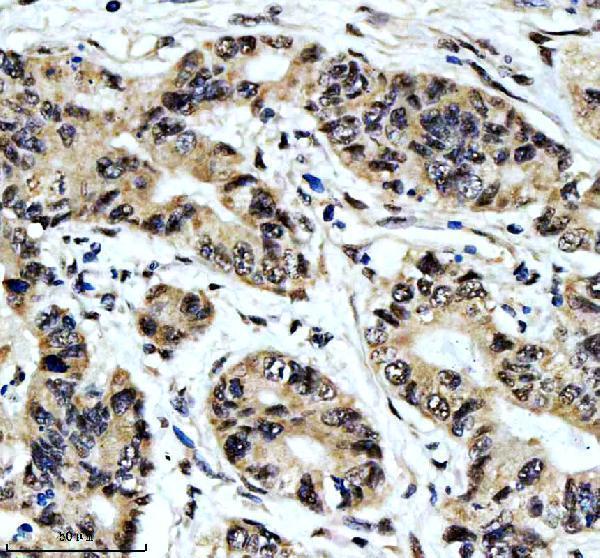 IHC analysis of CDC25C using anti-CDC25C antibody (M01343)
