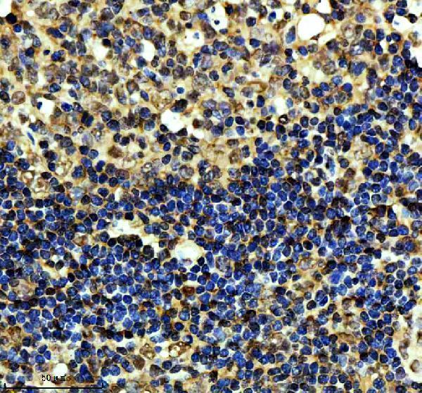 IHC analysis of CDC25C using anti-CDC25C antibody (M01343)