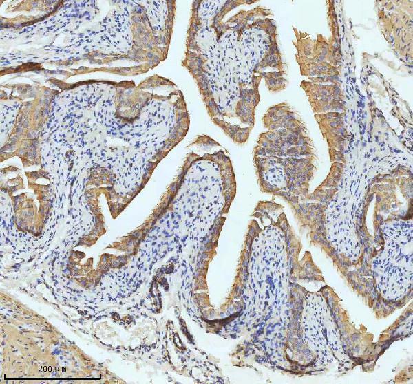 m01357 2 krt18 primary antibodies ihc testing 3