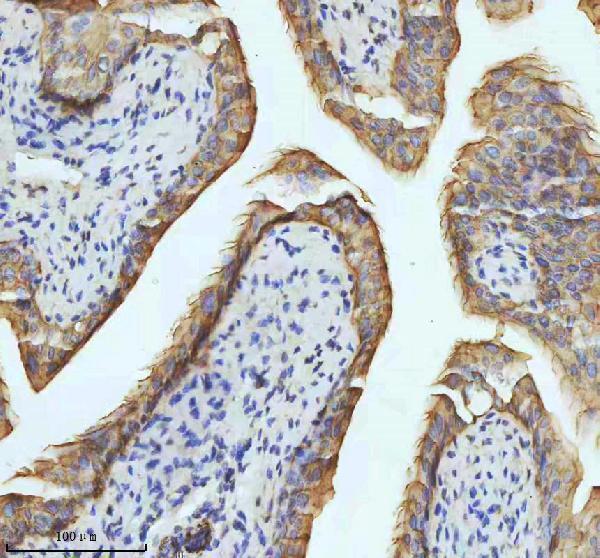 m01357 2 krt18 primary antibodies ihc testing 4
