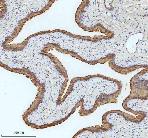 m01357 2 krt18 primary antibodies ihc testing 5