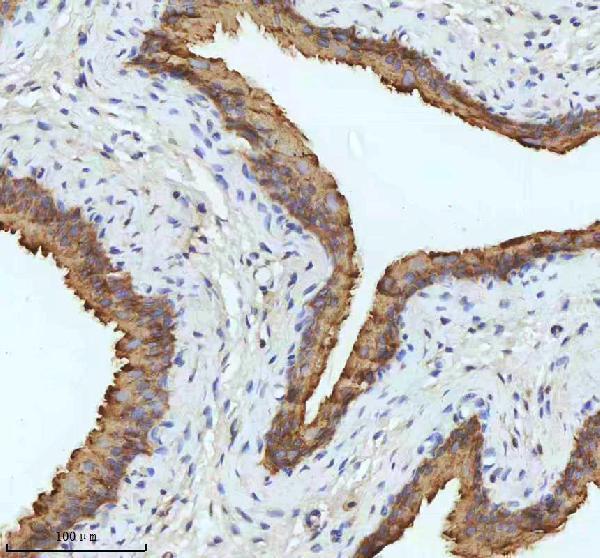 m01357 2 krt18 primary antibodies ihc testing 6