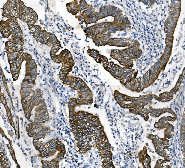  IHC analysis of Cytokeratin 18 using anti-Cytokeratin 18 antibody (M01357-4)