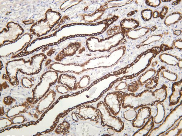 Human kidney was stained with anti-Cytokeratin 18 rabbit antibody