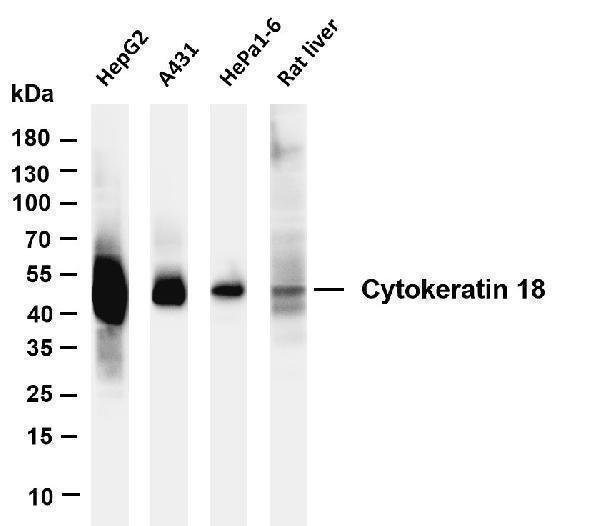 m01357 5 krt18 primary antibodies wb testing 1