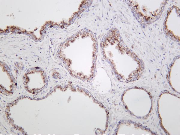 Human prostate was stained with anti-Cathepsin D rabbit antibody