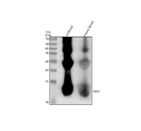 Western blot analysis of SAA1 using anti-SAA1 antibody (M01362)