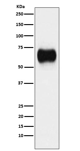 Western blot analysis of MICA expression in A431 cell lysate