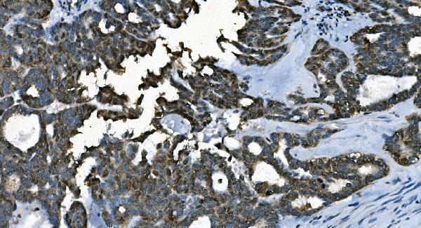 m01367 2 cdc45l primary antibodies ihc testing 2