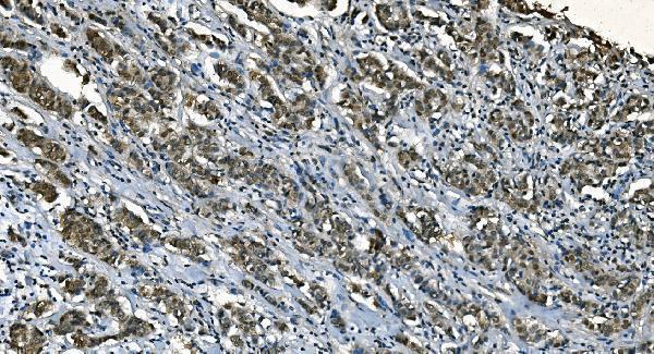 m01367 2 cdc45l primary antibodies ihc testing 3