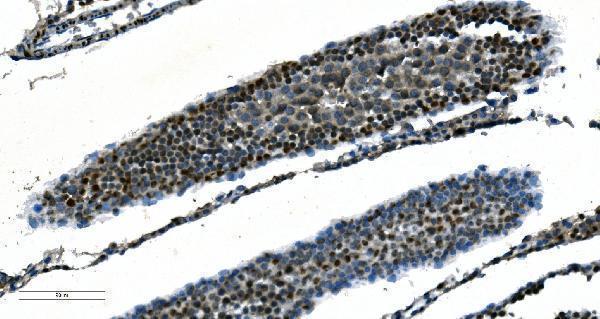 m01367 2 cdc45l primary antibodies ihc testing 7