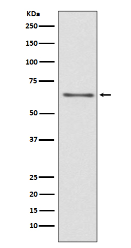 Western blot analysis of CDC45 expression in Jurkat cell lysate