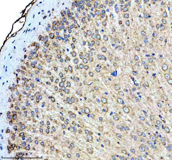 IHC analysis of PTN using anti-PTN antibody (M01368)