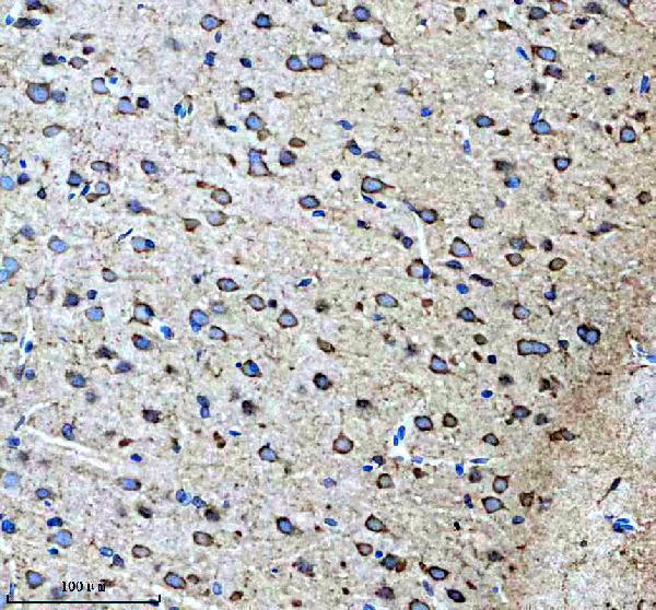 IHC analysis of PTN using anti-PTN antibody (M01368)