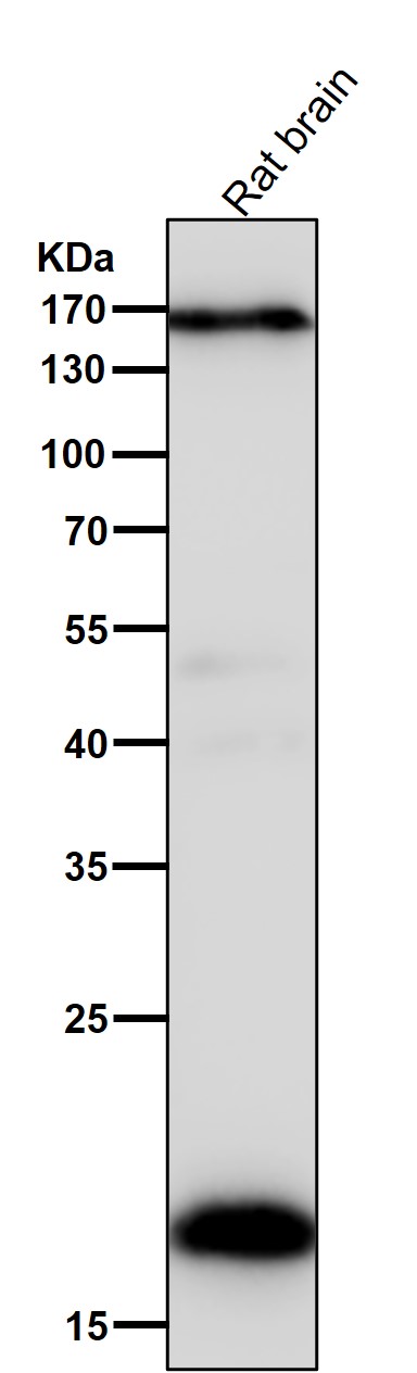 All lanes use the Antibody at 1:5K dilution for 1 hour at room temperature