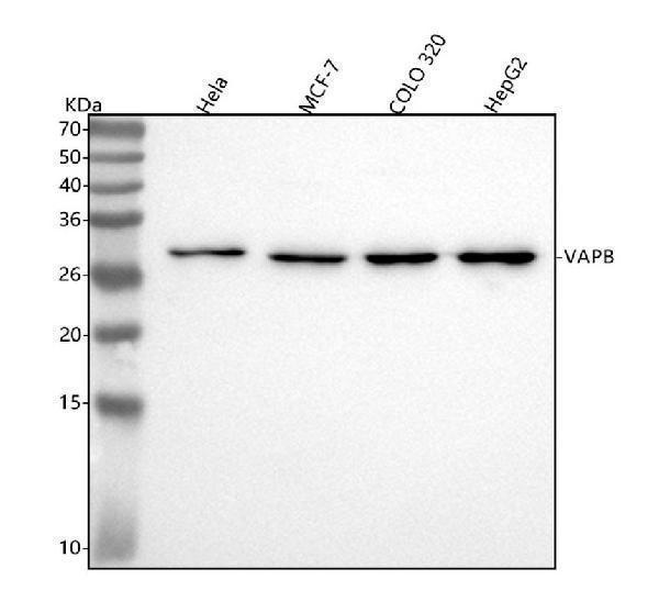 m01372 vapb primary antibodies wb testing 1