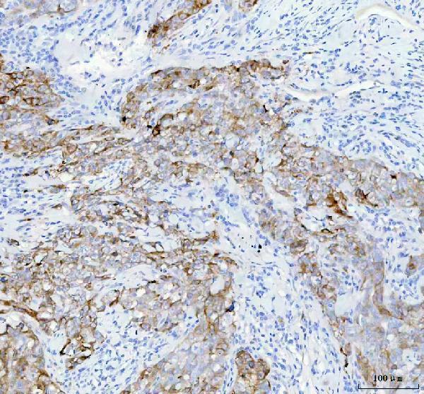  IHC analysis of IGFBP2 using anti-IGFBP2 antibody (M01373-1)