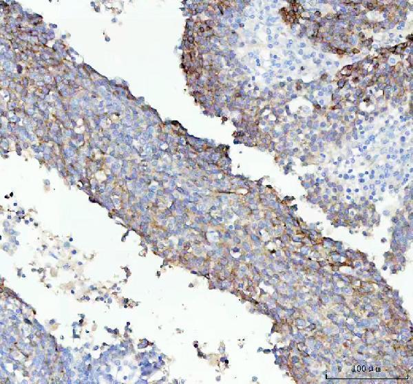  IHC analysis of IGFBP2 using anti-IGFBP2 antibody (M01373-1)