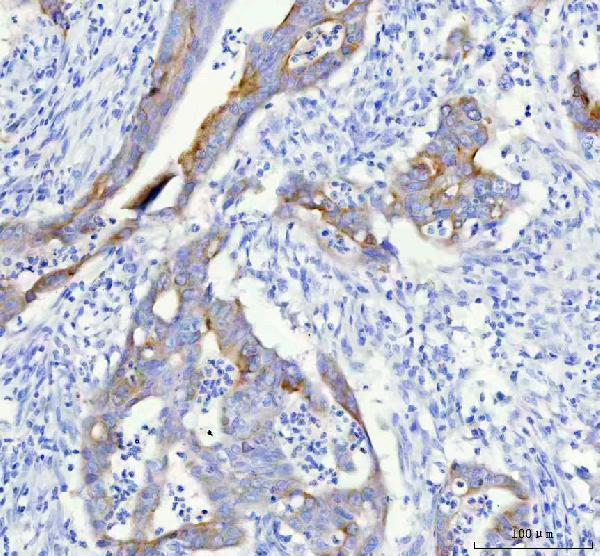 m01373 1 igfbp2 primary antibodies ihc testing 4