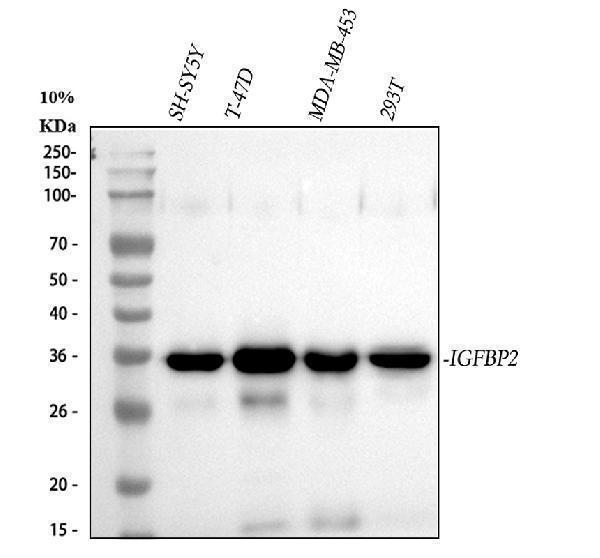  Western blot analysis of IGFBP2 using anti-IGFBP2 antibody (M01373-1)