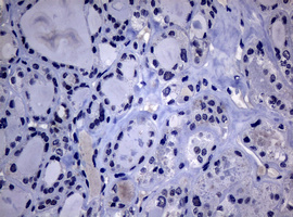 m01376 anti dna polymerase iota poli mouse monoclonal antibody clone id oti1c8 ihc testing 3