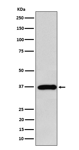 Western blot analysis of FBP1 expression in MCF7 cell lysate