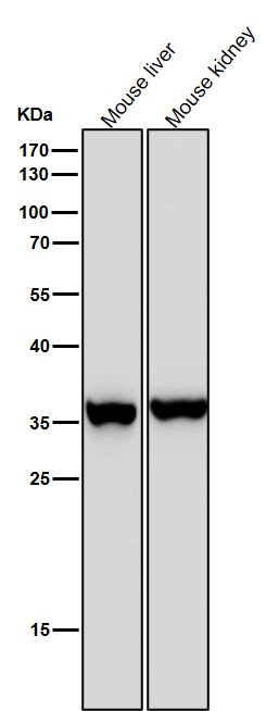 All lanes use the Antibody at 1:5K dilution for 1 hour at room temperature