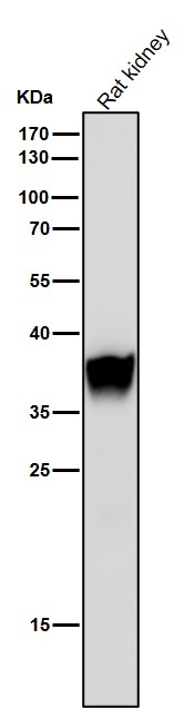 All lanes use the Antibody at 1:5K dilution for 1 hour at room temperature