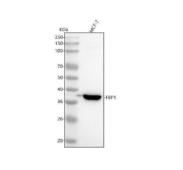  Western blot analysis of ACVR1 using anti-ACVR1 antibody (M01377)