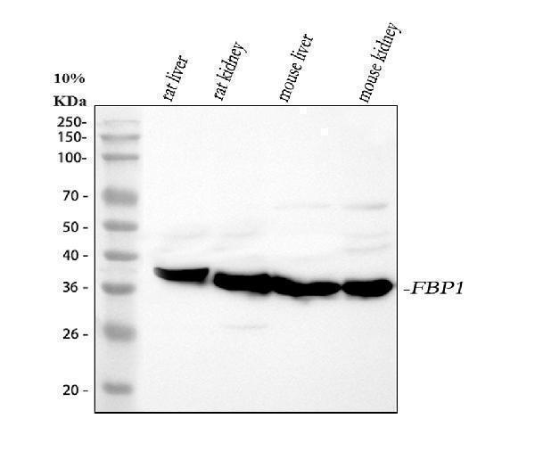  Western blot analysis of ACVR1 using anti-ACVR1 antibody (M01377)
