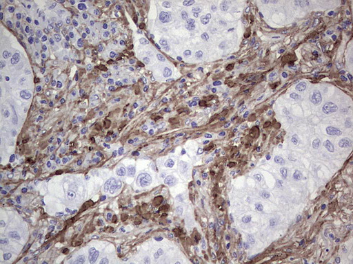 m01378 2 anti periostin postn mouse monoclonal antibody clone id oti2b2 ihc testing 2