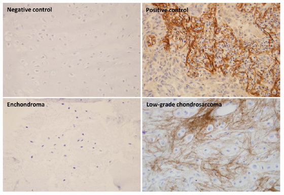 m01378 2 anti periostin postn mouse monoclonal antibody clone id oti2b2 ihc testing 3