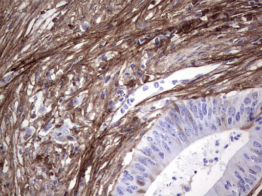 m01378 2 anti periostin postn mouse monoclonal antibody clone id oti2b2 ihc testing 4