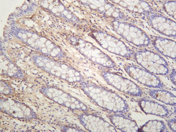 m01378 4 postn primary antibodies ihc testing 2