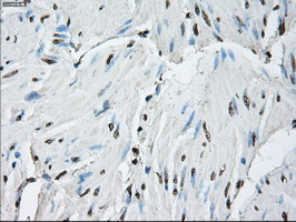 m01379 anti id3 mouse monoclonal antibody clone id oti5c7 ihc testing 10
