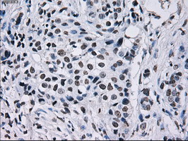 m01379 anti id3 mouse monoclonal antibody clone id oti5c7 ihc testing 11