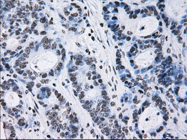 m01379 anti id3 mouse monoclonal antibody clone id oti5c7 ihc testing 13