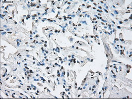 m01379 anti id3 mouse monoclonal antibody clone id oti5c7 ihc testing 16