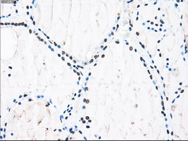 m01379 anti id3 mouse monoclonal antibody clone id oti5c7 ihc testing 5