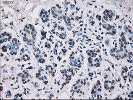 m01379 anti id3 mouse monoclonal antibody clone id oti5c7 ihc testing 9
