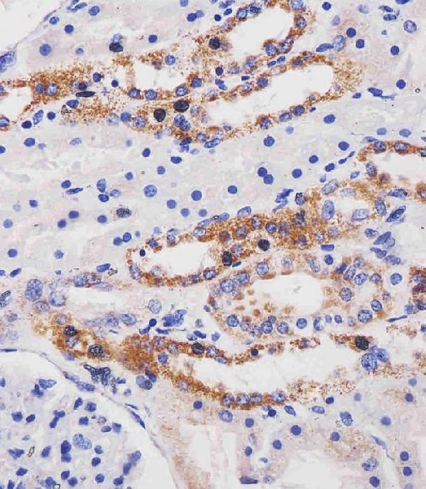 M01380 staining ME2 in human kidney tissue sections by Immunohistochemistry (IHC-P -paraformaldehyde-fixed, paraffin-embedded sections)