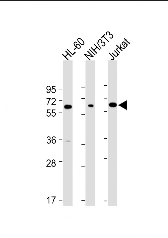 All lanes : Anti-ME2 Antibody (C-term) at 1:4000 dilutionLane 1: HL-60 whole cell lysateLane 2: NIH/3T3 whole cell lysateLane 3: Jurkat whole cell lysateLysates/proteins at 20 µg per lane
