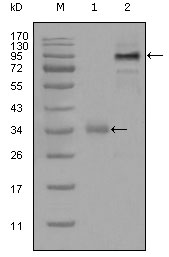m01383 etv1 primary antibodies wb testing 1