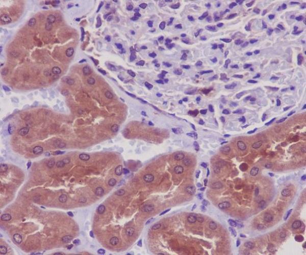 Immunohistochemical analysis of paraffin-embedded human kidney, using PKR Antibody