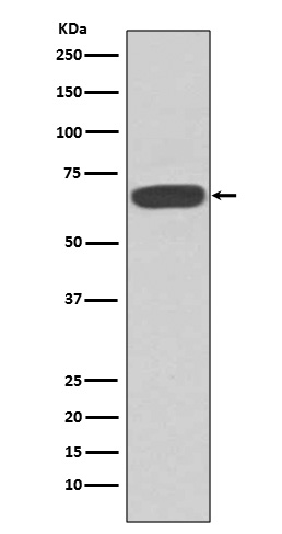 Western blot analysis of PKR expression in MCF-7 cell lysate