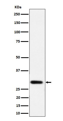 Western blot analysis of NAT1 expression in LnCaP cell lysate