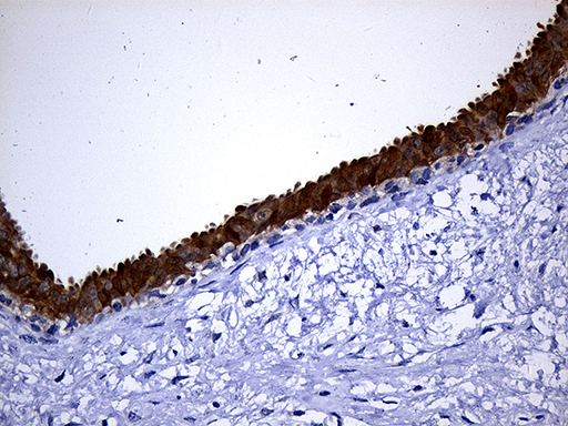 Immunohistochemical staining of paraffin-embedded Human breast tissue within the normal limits using anti-NAT1 mouse monoclonal antibody
