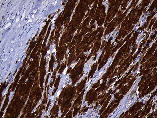 m01386 anti nat1 mouse monoclonal antibody clone id oti6d7 ihc testing 5