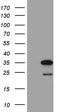 HEK293T cells were transfected with the pCMV6-ENTRY control (Left lane) or pCMV6-ENTRY NAT1 (Right lane) cDNA for 48 hrs and lysed